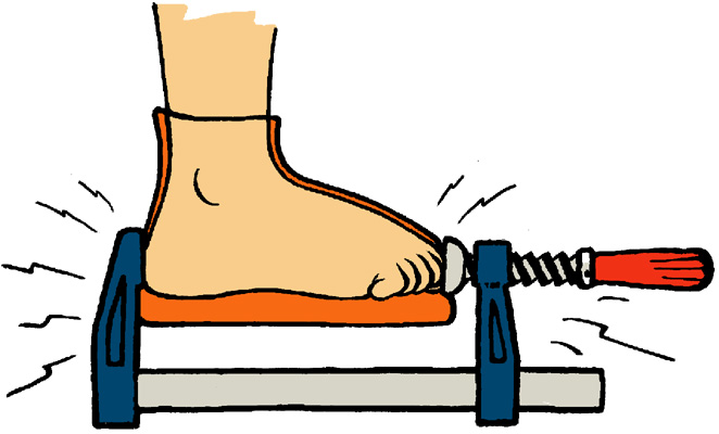 A child's foot in a ferrule to show the problem with shoes that are too short.